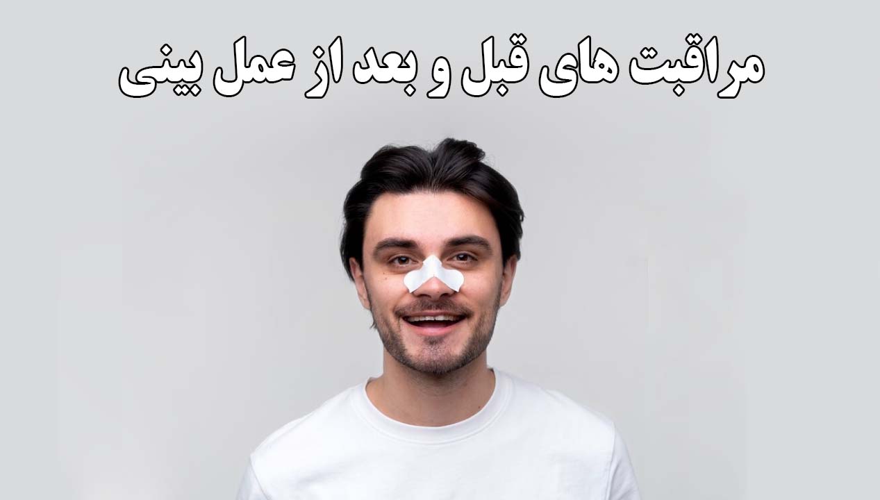 مراقبت های قبل و بعد از عمل بینی