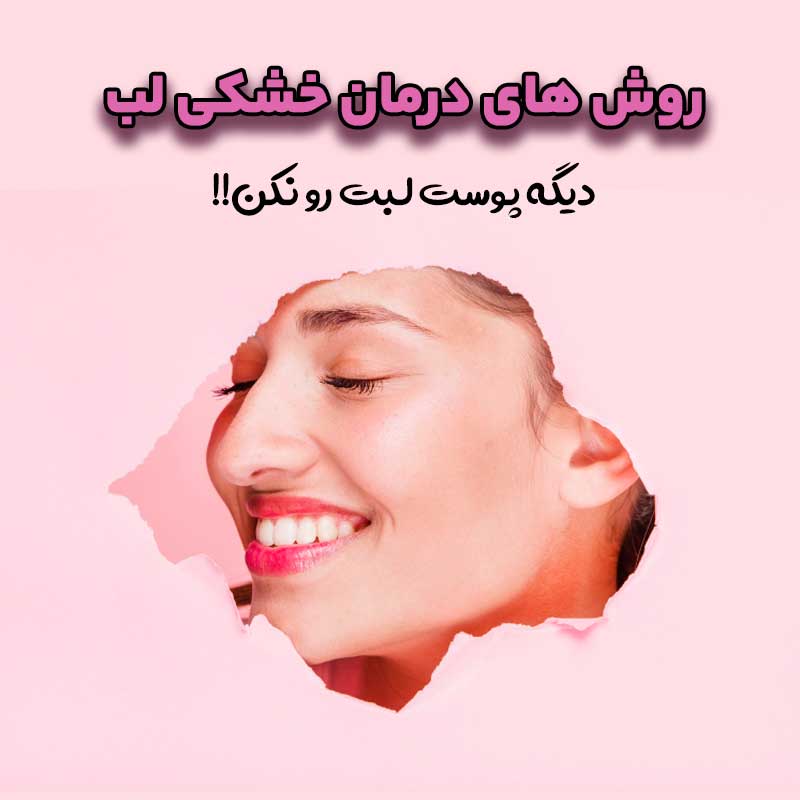 خشکی لب