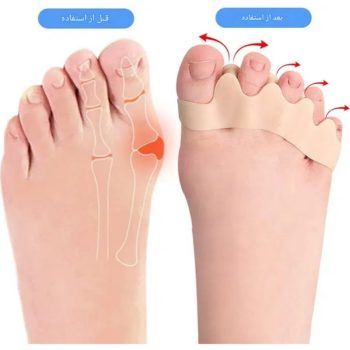 فاصله دهنده و اصلاح کننده فرم انگشتان پا سیلیکونی H2